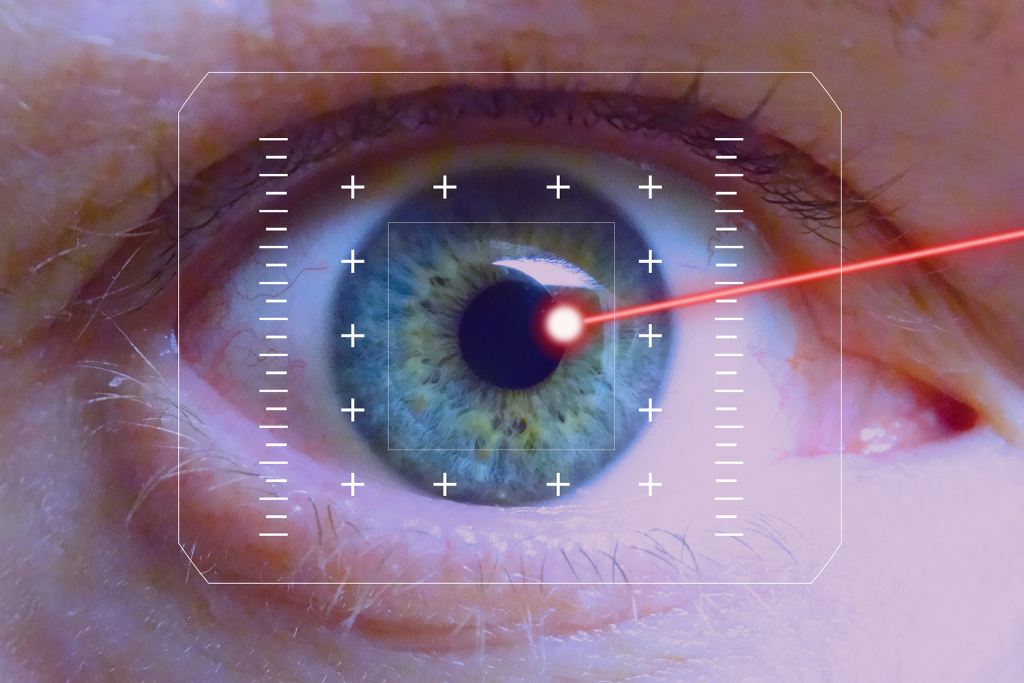 Presbicia o vista cansada 3 operación LASIK cirugía refractiva PRK